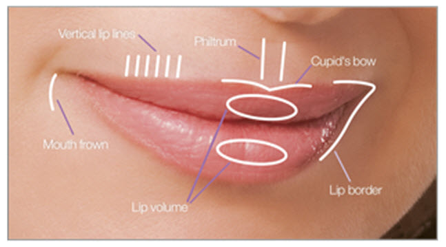 lip shaping